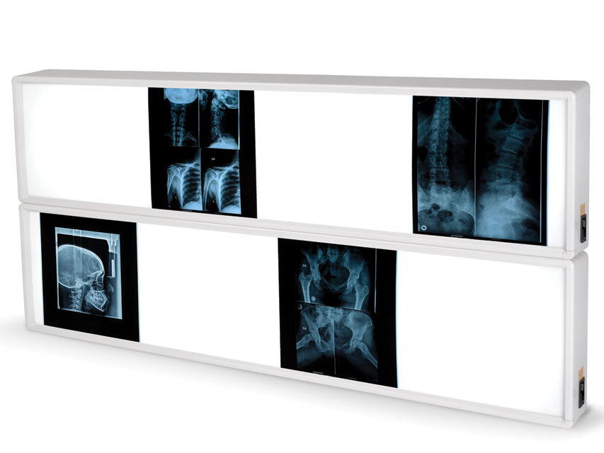 NEGATIVESCOPE 2x4 PANELS 76 x 153 cm