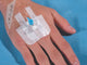 TEGADERM 3M I.V. ADVANCED 6,5x7 cm per linee periferiche